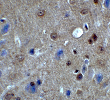 PACS1 Antibody