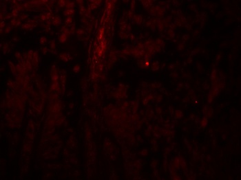 PACS1 Antibody