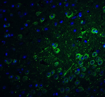 PACS1 Antibody