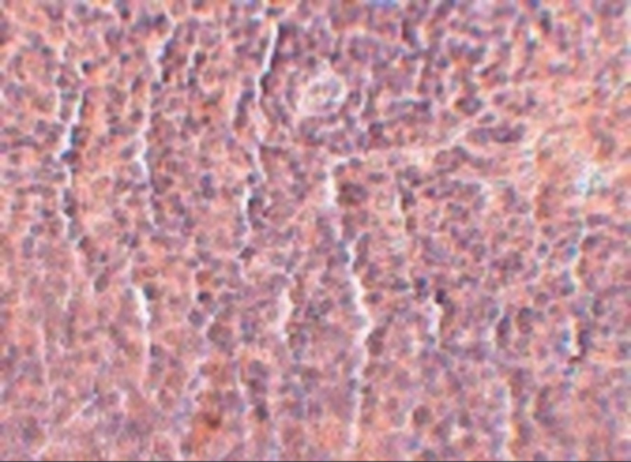 ORAI3 Antibody [2H2G9]