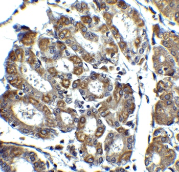 Noxa Antibody