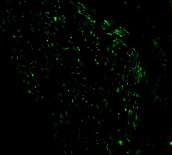 Noxa Antibody
