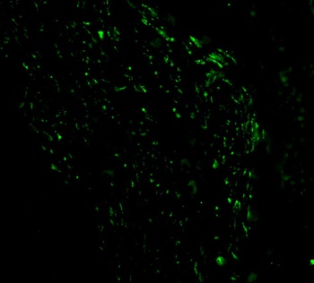 Pmaip1 Antibody