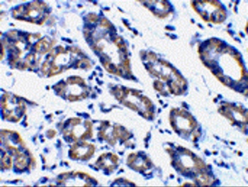 Pmaip1 Antibody