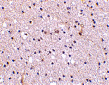 Nicastrin Antibody