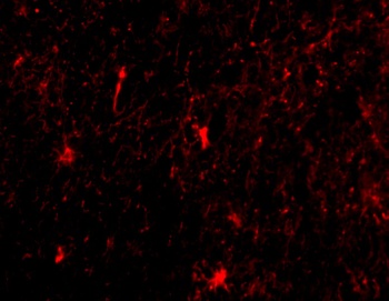 Nicastrin Antibody