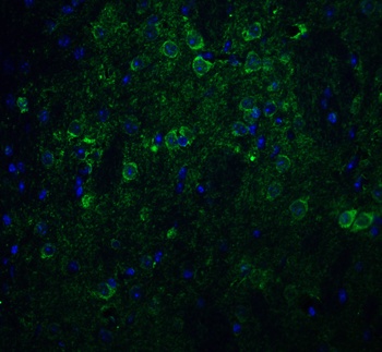 NCSTN Antibody