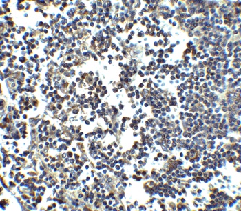 MDA5 Antibody