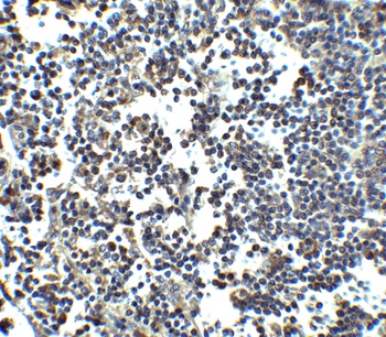 IFIH1 Antibody