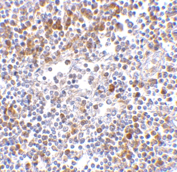 IFIH1 Antibody