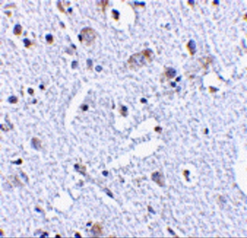 TIGAR Antibody
