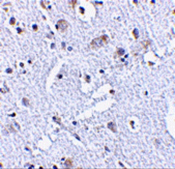 C12orf5 Antibody