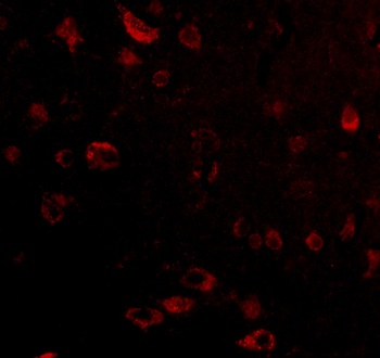 C12orf5 Antibody