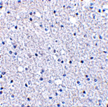 TIGAR Antibody