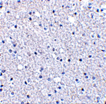 C12orf5 Antibody