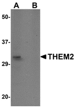 ACOT13 Antibody