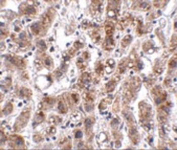 ACOT13 Antibody