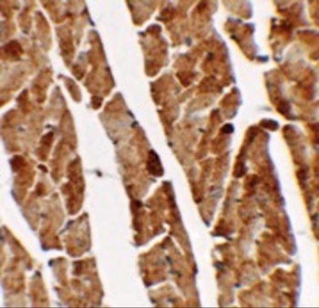 TGM5 Antibody