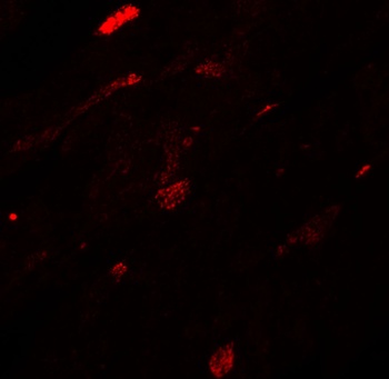 TGM5 Antibody