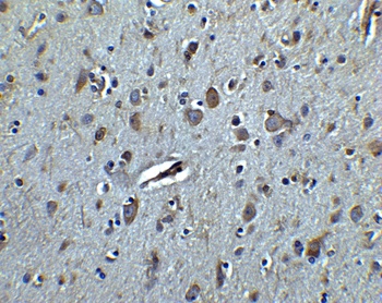 TET3 Antibody