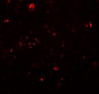 TET3 Antibody