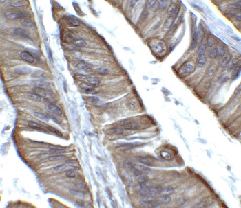 TET2 Antibody