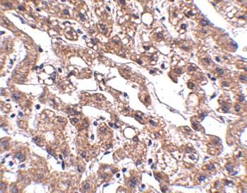 MACC1 Antibody