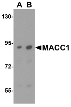 MACC1 Antibody