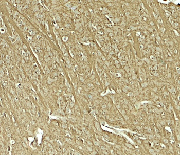 TENM1 Antibody