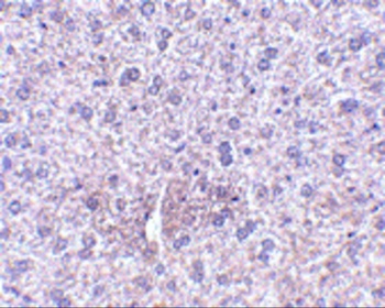 PLXDC1 Antibody