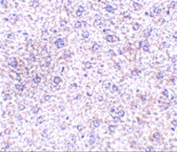 TEM7 Antibody