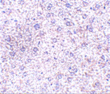 PLXDC1 Antibody