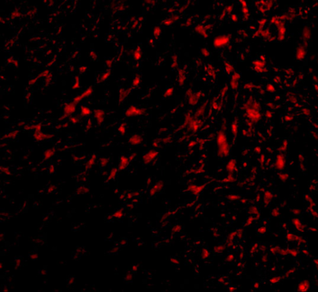 GPR124 Antibody