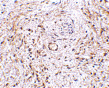 TEM5 Antibody