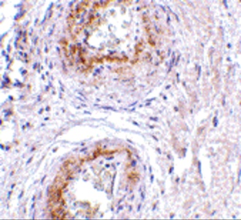 GPR124 Antibody