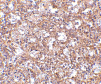TEM4 Antibody
