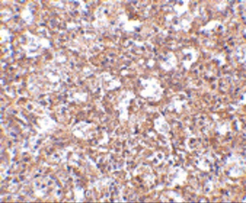 ARHGEF17 Antibody