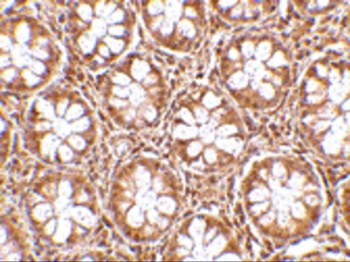 RASD2 Antibody