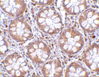 TEM2 Antibody