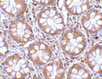 RASD2 Antibody