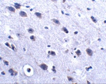 LRFN2 Antibody