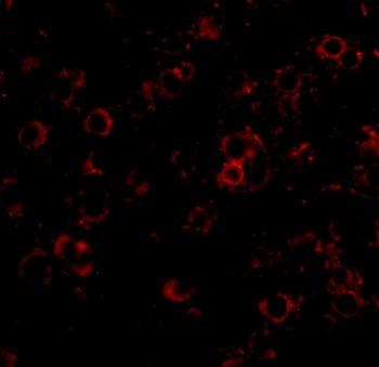 LRFN2 Antibody