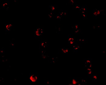 TARDBP Antibody