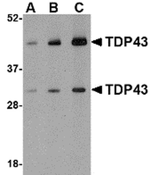 TARDBP Antibody