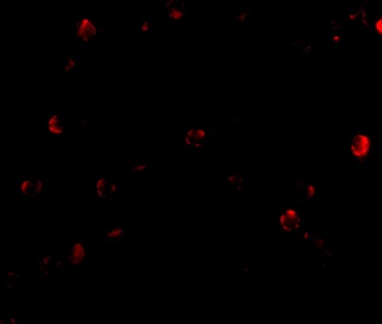 TARDBP Antibody