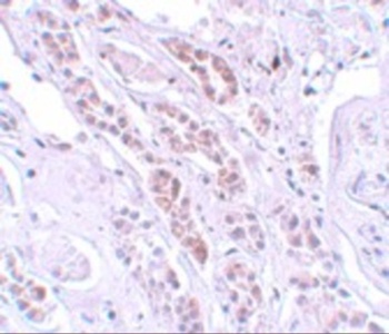 TCTN1 Antibody