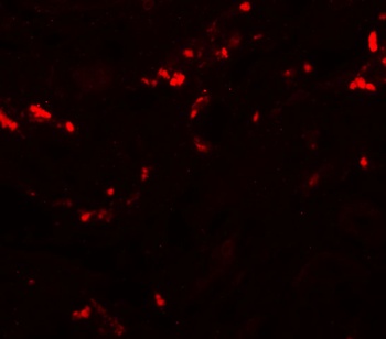 TCTN1 Antibody