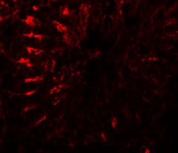 TCTEX1D3 Antibody