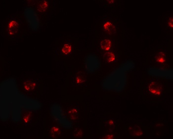 TCTEX1D2 Antibody