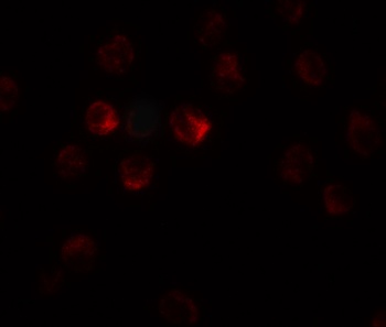 TCTEX1D1 Antibody